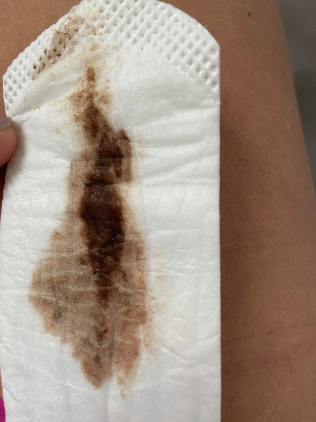 Brown discharge ?